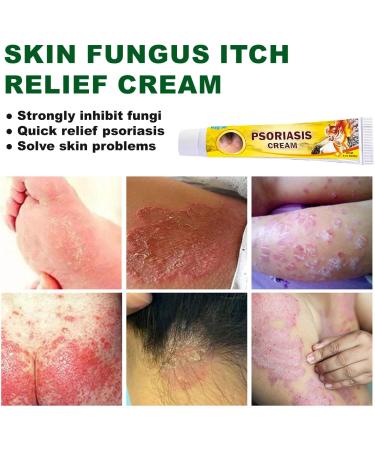  MagiSel Anti-itch ointment soothing skin cream for itching and psoriasis natural care formula skin cream cares for and soothes the skin non-irritating (20 g) - Buy Online on GoSupps.com