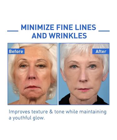 Botox Stock Solution Facial Serum | Newest Instant Face Lift Cream for Women | Dark Spot Corrector & Anti-Aging Collagen Serum | 30ml (2pcs) - Buy Online on GoSupps.com