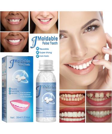 Temporary Tooth Repair Kit - Dental Glue for Fixing Missing Teeth - Buy Online on GoSupps.com