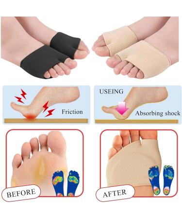 2 Pairs Metatarsal Pads for Men & Women - Gel Forefoot Cushion Sleeves - Pain Relief for Ball of Foot (XL - 1 Black & 1 Beige - Buy Online on GoSupps.com