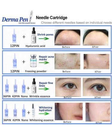 Buy Electrical Microneedling Pen for Skin Care | Dermapen & Dermaron Roller | Treat Wrinkles Acne Scars Stretch Marks Hair Loss | 0.25-2.5mm 12pin 36pin Nano Needles | International Shipping Available - Buy Online on GoSupps.com