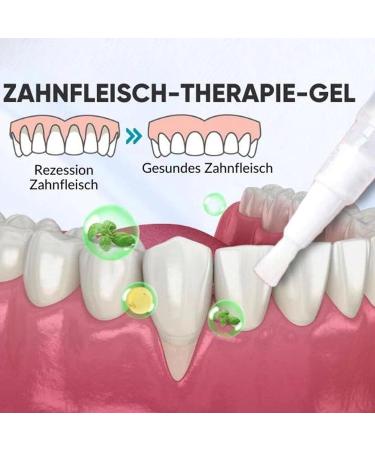 Dentiz Gums Therapy Gel & Tooth Whitening Pen Set - 5 PCs - Effective Gum Care & Brightening Solution | Shop Internationally Now! - Buy Online on GoSupps.com
