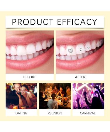 DIY Tooth Gem Kit - Shiny Decorations With UV Light & Strong Adhesive Easy Application For Unique Smile(2PC) - Buy Online on GoSupps.com
