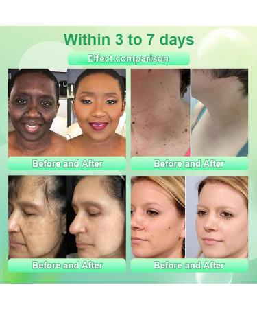 Purifying Exfoliating Gel Professional Purifying Exfoliating Gel Advanced Exfoliating Gel Exfoliating Gel for Face and Body Exfoliating Gel for All Skin Types Deep Cleansing (1 Pack) - Buy Online on GoSupps.com