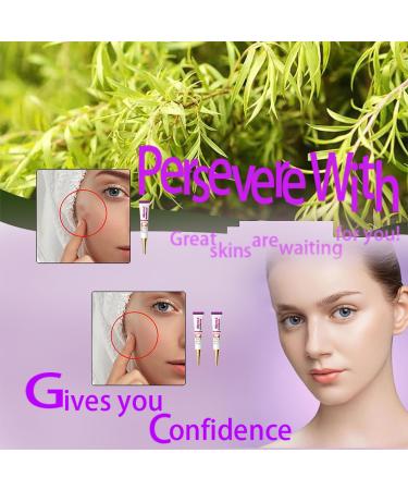 Premium Dark Spot Remover for Face - Niacinamide Cream for Age Spots Sun Spots and Freckles - 20G - Buy Online on GoSupps.com