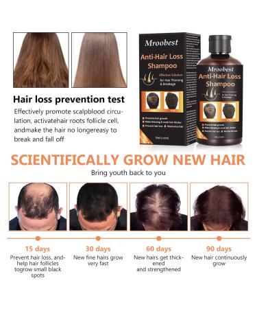 Ginger Hair Growth Shampoo & Conditioner Set | Anti Hair Loss, Promotes Fast Hair Growth, Moisturizes & Strengthens Thin/Damaged Hair - 14.67 oz - Buy Online on GoSupps.com