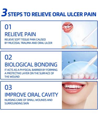 Mouth Ulcer Spray Ulcer Breath Sprays Mouth Ulcer Treatment Spray Ulcer Treatment Canker Sore Treatment Canker Relief Spray Oral Ulcer Sprays Herbal Mouth Spray Dry Mouth Relief Treat Mouth Ulcer - Buy Online on GoSupps.com