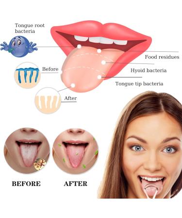 Stainless Steel Tongue Scrapers - 2 Pack Metal Cleaners for Fresh Breath | Rose Gold Tongue Cleaner for Adults & Kids - Buy Online on GoSupps.com