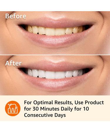 Amazon Basics 10-Day Teeth Whitening Strips Kit - 10 Treatments, 1-Pack | Effective Whitening Strips, Easy to Use - Buy Online on GoSupps.com