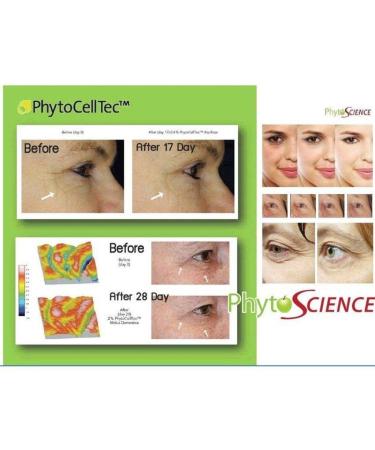 PhytoScience Double Stemcell - All-Natural Pack for Enhanced Wellness - Buy Online on GoSupps.com