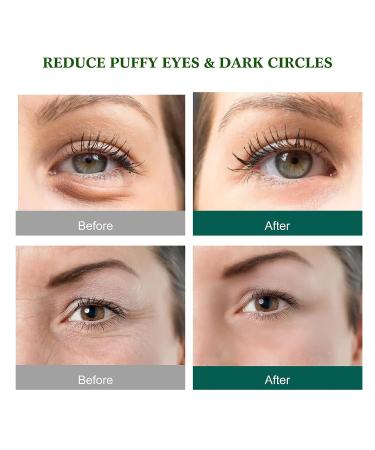 60 Pcs Aloe Vera Under Eye Masks - Reduce Puffy Eyes, Dark Circles, Wrinkles & Fine Lines - Natural Ingredients for Youthful, Firm Skin - Buy Online on GoSupps.com