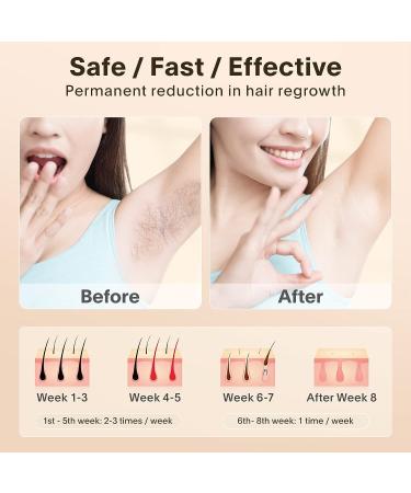 Laser IPL Hair Removal Device for Women & Men | Professional At-Home Hair Remover with 999,999 Flashes - Buy Online on GoSupps.com