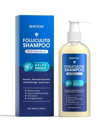SHVYOG Anti-dandruff shampoo reduces dandruff relieves itching and redness of the scalp antifungal shampoos for seborrheic dermatitis folliculitis leather psoriasis