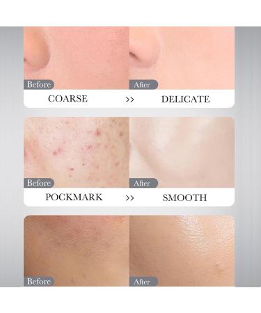 Dyceittdia Purifying Mask 10-piece Marine Mud Mask Applicator Mask Moisturising Mask Cleanses Pores Brightens Skin Diminishes Fine Lines - Buy Online on GoSupps.com