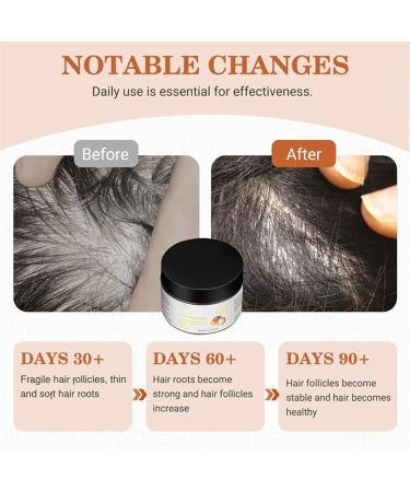Anti-Loss Hair Oil | Moisturizing Dry Hair Oil for Women Repairing Moisturizing Care for Women and Men Reduces Breakage and Frizz - Buy Online on GoSupps.com