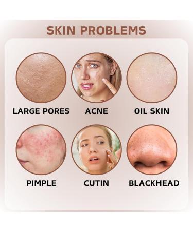 Retinol Serum for Face - Retionl Face Serum with Niacinamide - Anti-Aging & Anti-Wrinkle Face Serum for Women - Niacinamide Serum - Hydrating Serum - Dark Spot Remover for Face - Skin Care - Buy Online on GoSupps.com