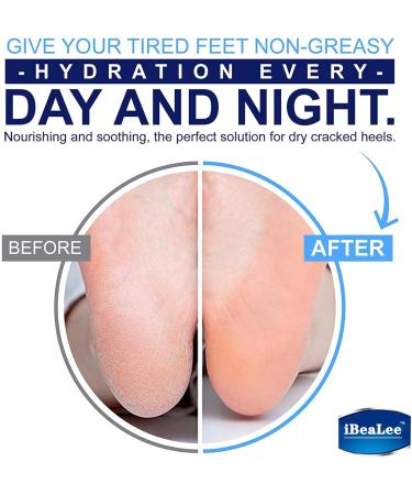 Urea Foot Cream for Dry Cracked Heels and Feet Cracked Foot Repair Ultra-Hydrating Foot Cream 35g Callus Remover For Dry And Hard Skin Foot Lotion for Dry Cracked Feet Heals & Moisturizes - Buy Online on GoSupps.com
