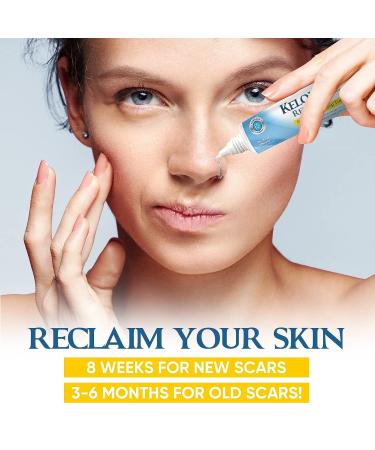 Advanced Silicone Scar Gel for Keloid Bump Removal & Treatment - Nose, Ear, Belly Piercings, Stretch Marks, Burn, Surgical, C-Section, Old & New Scars - Buy Online on GoSupps.com