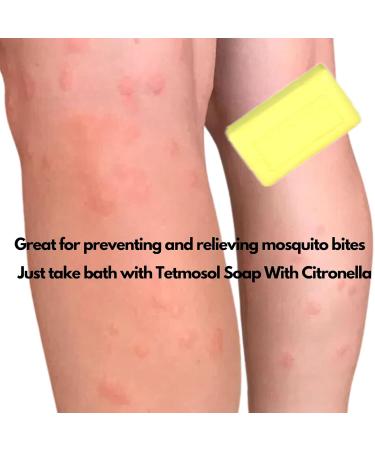 Tetmosol Medicated Soap with Citronella 120g - Best for Skin Care | International Shipping Available - Buy Online on GoSupps.com