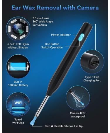TopWigy Ear Wax Removal Tool with 1440P Camera, 6 LED Lights & 6 Spoons - Waterproof 5MP HD Ear Otoscope for iOS & Android - Black - Buy Online on GoSupps.com