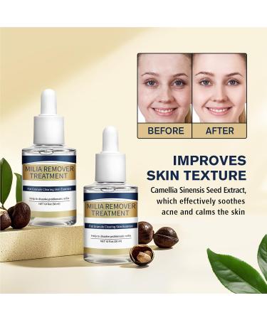  Huxibai Moisturizing Face Serum 30 ml Luminous Moisturizing Solution Emollient Face Cream for Sensitive Skin with Redness Types - Buy Online on GoSupps.com