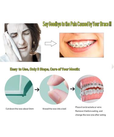 10 Boxes of Orthodontic Wax for Braces - Relieve Irritation & Pain | 10 Flavors Available | International Shipping - Buy Online on GoSupps.com