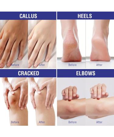 HOUSN UREA Feet Cream Stick 2 pieces repair stick with shea butter and coconut oil foot cream very dry feet calluses and intensive foot care against cracked heels 2 pieces UREA Feet Cream 2 PCS UREA Feet Cream - Buy Online on GoSupps.com