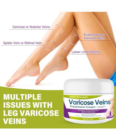 Effective Varicose Veins Treatment Cream | Relieve Leg Swelling & Improve Circulation - Buy Online on GoSupps.com