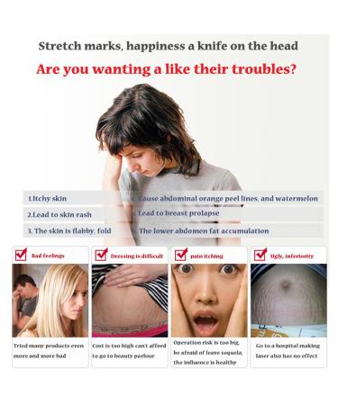 AICHUN BEAUTY Stretch Marks Cream with Snail Extract | Reduce Scars & Repair Damaged Skin | 120g - International Shipping Available - Buy Online on GoSupps.com