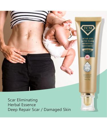 Scar Removal Cream - 30g - Fade Scars, Stretch Marks & Burns - Moisturizing Facial Skin Repair Treatment - Buy Online on GoSupps.com