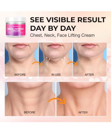 Everlom Neck Firming Cream - Advanced 65 ML Formula for Tightening & Lifting Loose Skin on Neck, Jawline & Chest - Anti Aging Moisturizer for All Skin Types - Buy Online on GoSupps.com