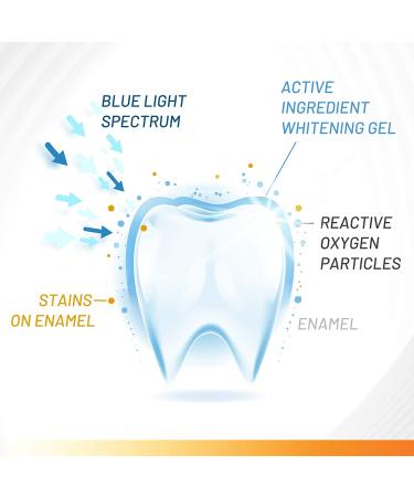 White Glo Accelerator Teeth Whitening Kit - Sensitive Teeth & Gums - 3 Months Treatment - Carbamide Peroxide Formula with Papaya Pineapple Enzyme - Buy Online on GoSupps.com