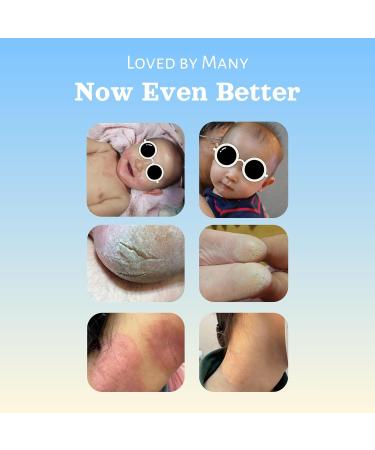 Natural SKIN REPAIR. Clinically tested Aromatherapy. Powerful Essential Oil. Eczema Dermatitis Diaper rash and Sensitive skin. For all skin types. Hypoallergenic Vegan Paraben Free. 50ML TUBE Tube 50ml - Buy Online on GoSupps.com