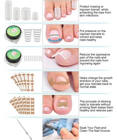 BLATOWN Ingrown Toenail Removal Kit - Treatment & Corrector Tools for Toe Pain Relief - Buy Online on GoSupps.com