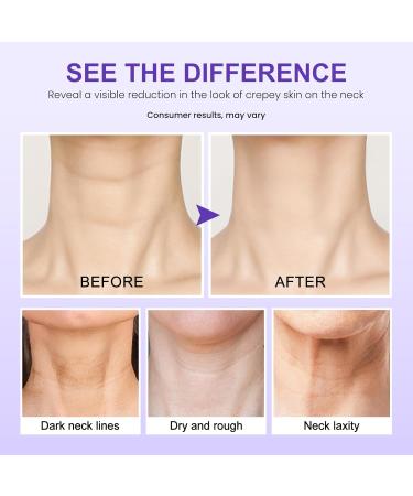 Buy Tighten & Lift Neck Firming Cream - Anti-Aging Neck Cream for Sagging Skin 1.76 oz - Fast International Shipping - Buy Online on GoSupps.com