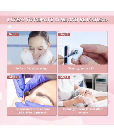 Blackhead Acne Removal Extractor Kit | Professional Stainless Pimple Blemish Tools with Storage Box - 4PCS - Buy Online on GoSupps.com