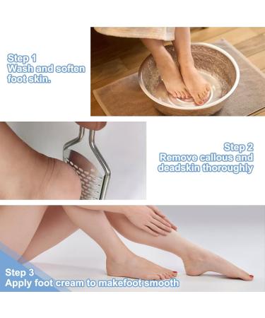 Untrytb Professional Foot Scrubber Dead Skin Remover Pedicure Foot File Callus Remover Heel Scraper for Cracked Heels Foot Rasp for Hard Skin Colossal Exfoliator Tool (T1) - Buy Online on GoSupps.com