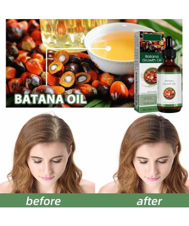 Batana Oil Organic for Healthy Hair 60ml Hair Growth Oil Strengthening and Thickening Hair Repair Damaged Hair Nourishes Scalp Natural Raw Batana Hair Oil for Women and Men - Buy Online on GoSupps.com