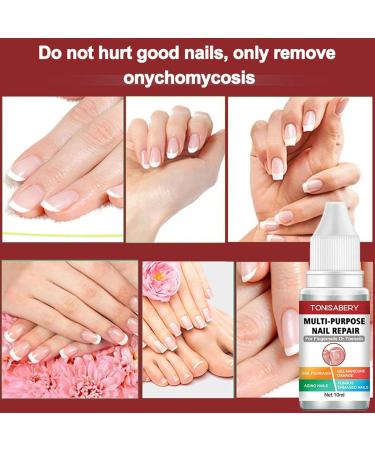 Toenail Repair Solution Extra Strong Finger and Toenail Repair Fluid 10 ml nail repair serums for toenail or fingernail repair and renew nail damage Yunmiao - Buy Online on GoSupps.com