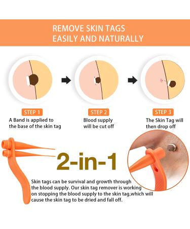 MEIJU Skin Tag Removers | 2-in-1 Removal Kit for Small to Large Skin Tags | Easy Application Device with 36 Repair Patches - Yellow - Buy Online on GoSupps.com