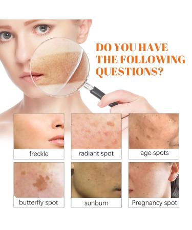 OLLZPJFPK Papaya Whitening Freckle Cream Lightens Facial Freckles Dark Spots Brightens Moisturizes Skin Day and Night Cream - Buy Online on GoSupps.com