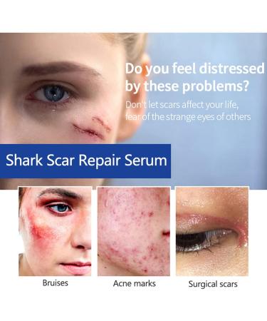 Scar Water Scar Liquid 30ml Scar Moisturizing Oil with Selfie Lip Filler - Color One Size - Buy Online on GoSupps.com