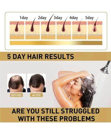 Shampoing au gingembre produits capillaires au gingembre - Anti-chute soin anti-perte de cheveux cheveux pais et plus longs pour la perte de cheveux et l'amincissement des cheveux - Pour homme - Buy Online on GoSupps.com