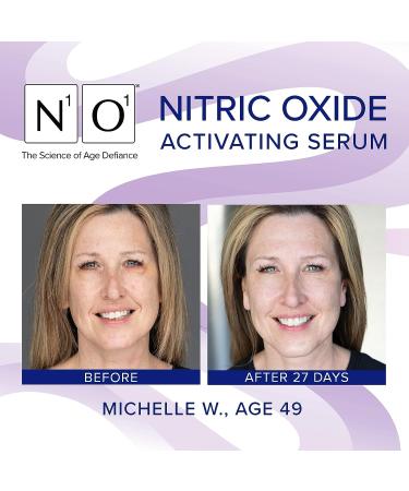 N1O1 Nitric Oxide Activating Serum | Antioxidant-Rich Hydrating Face Serum | Decreases Wrinkles, Minimizes Pores, Improves Skin Texture | 1 Fl Oz - Buy Online on GoSupps.com
