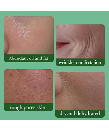 Q10 Day Cream for Face - Face Cream for Anti Aging - Anti Wrinkle Face Cream with Retinol and Collagen - Hydrating Face Cream for Dry Skin - Moisturiser Face Women - Firming Smoothing Moisturising - Buy Online on GoSupps.com
