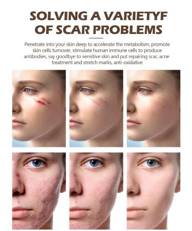 Vibrant Glamour Cayman Repair Gel: Acne Scar & Skin Scar Removal Ointment - 20g - Buy Online on GoSupps.com
