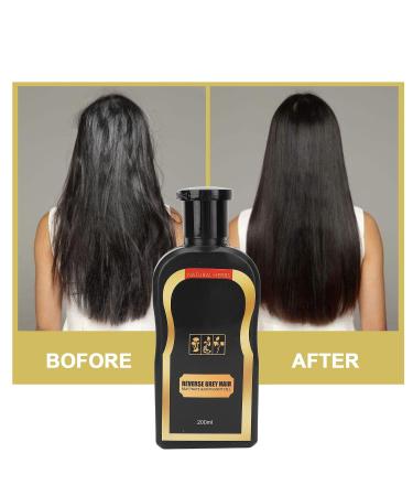 Chinese Grass Scented Anti-Hair Loss Shampoo & Oil for Dandruff Control | Quick Hair Growth & Strengthening | International Shipping Available - Buy Online on GoSupps.com