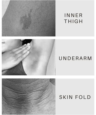 Skin Lightening Cream Underarm Whitening Products Whitening Cream for Underarm Inner Thigh and Bikini Areas Skin Bleaching Cream for Quickly Absorb & Reduce Odor Smoothing Non-Greasy - Buy Online on GoSupps.com