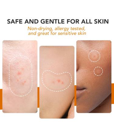 JOLVKA Large Pimple Patch XL - 116 Hydrocolloid Spot Dots Variety Pack for Face Blemishes - Zit Patches Stickers for Acne Cover Up - Buy Online on GoSupps.com