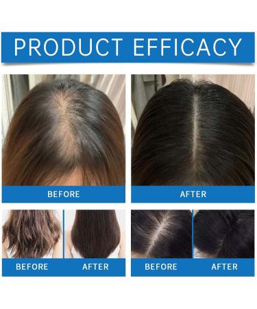 Clawrex Rollon hair growth oil hair growth serum hair care oil for deep nourishment and repair of hair roots hydration antifrizz hair breakage repair - Buy Online on GoSupps.com